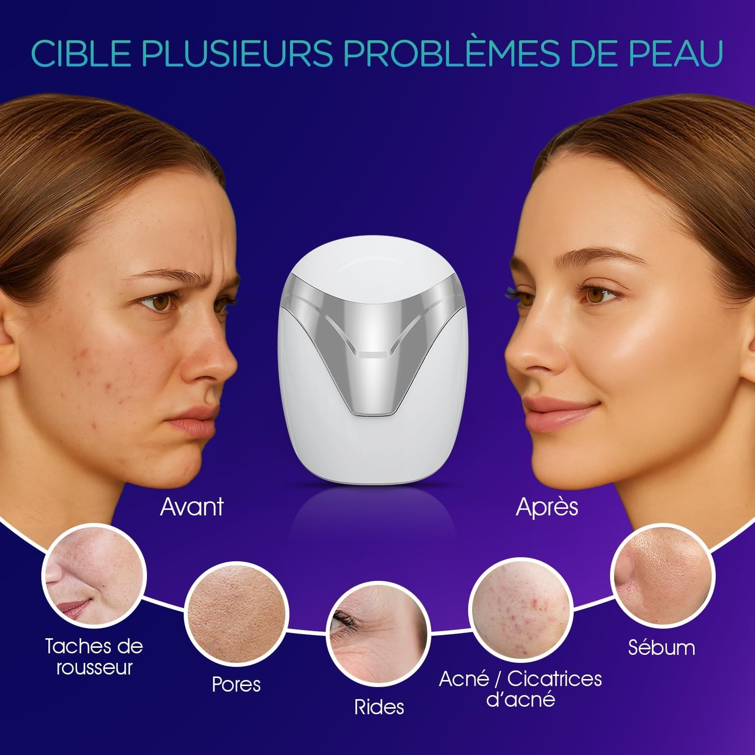 Masque LED Visage Masque Luminothérapie Visage Traitement Professionnel De L'Acné/Lisser Les Rides/Photorajeunissement Soins De La Peau Sans Fil Rechargeable 3 Couleurs Rouge/Bleu/Violet BM100